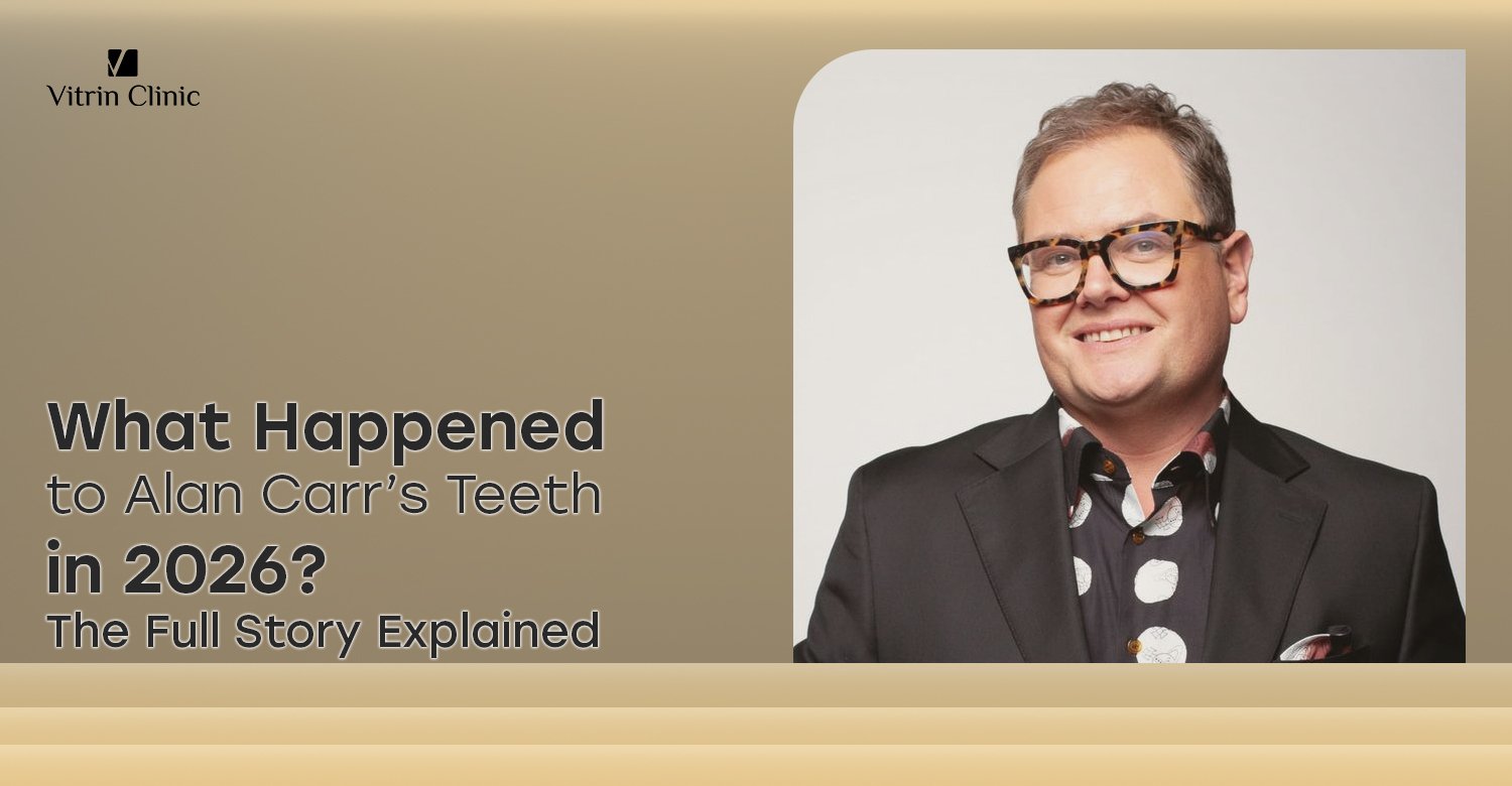 Alan Carr Teeth