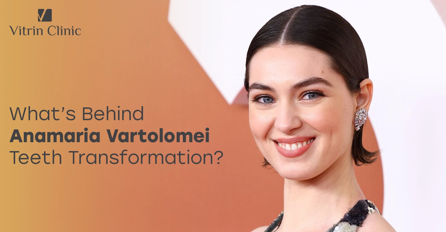 Anamaria Vartolomei Teeth