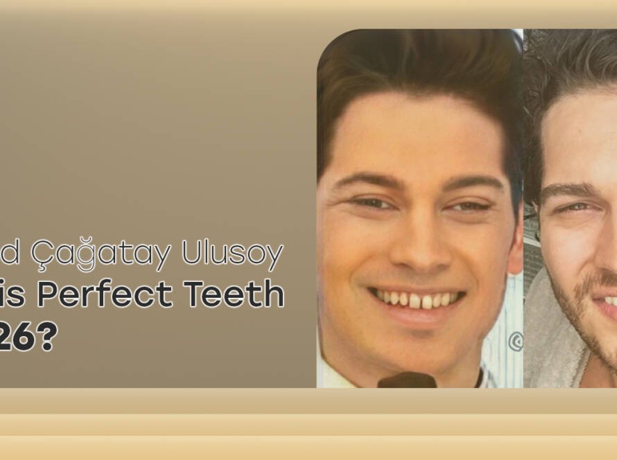 Cagatay Ulusoy Teeth