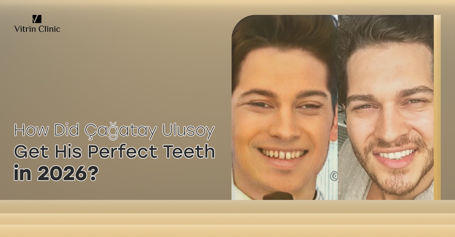 Cagatay Ulusoy Teeth
