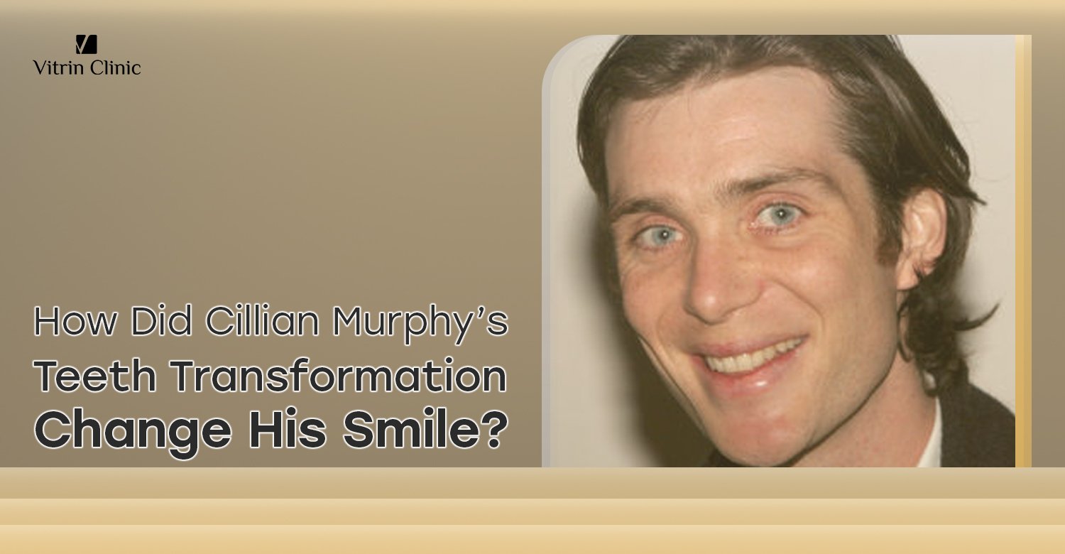 Cillian Murphy Teeth