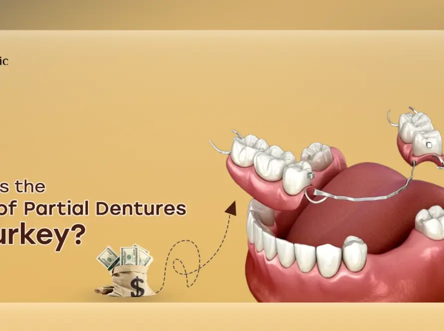 Cost of partial dentures