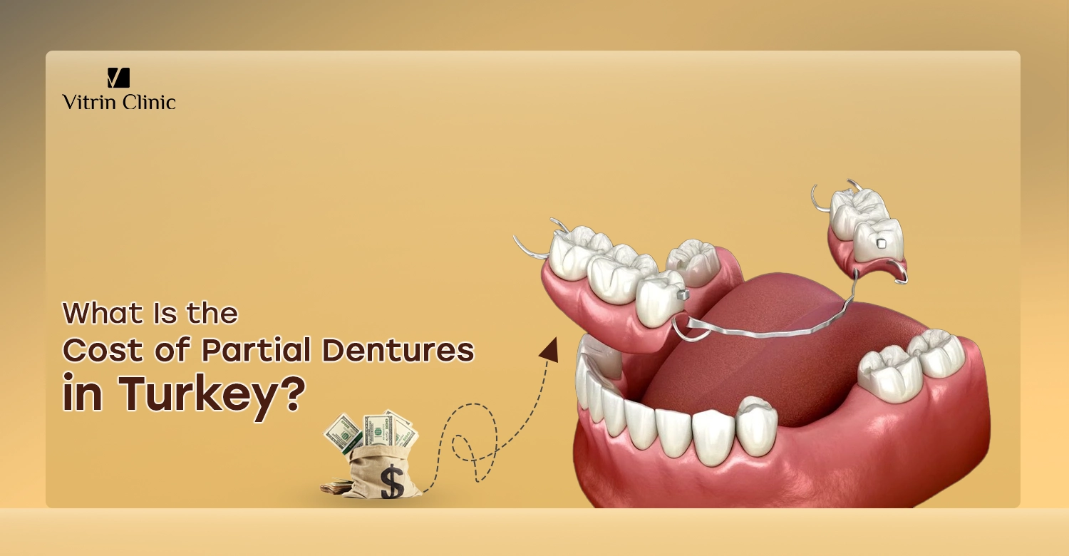Cost of partial dentures