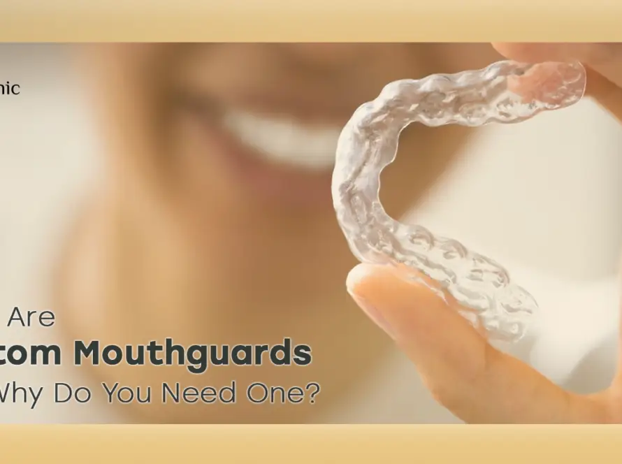Custom mouthguards