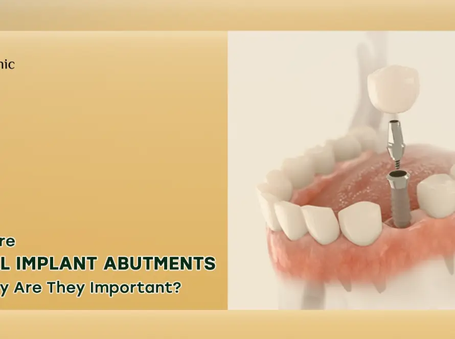 Dental implant abutments