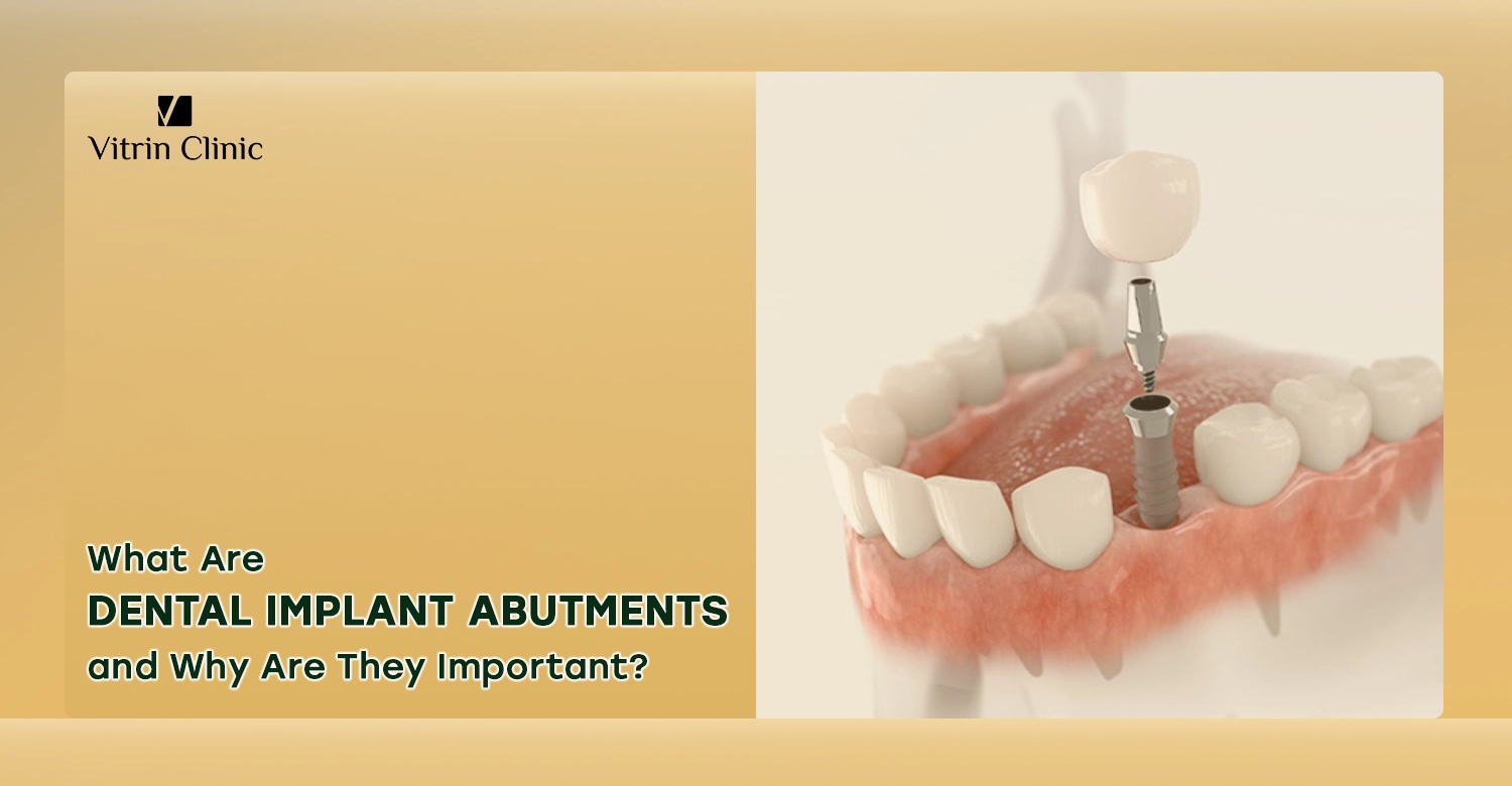 Dental implant abutments