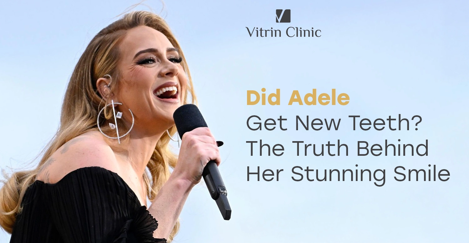 Adele smile: The Truth Behind Her Stunning 2026 teeth Transformation