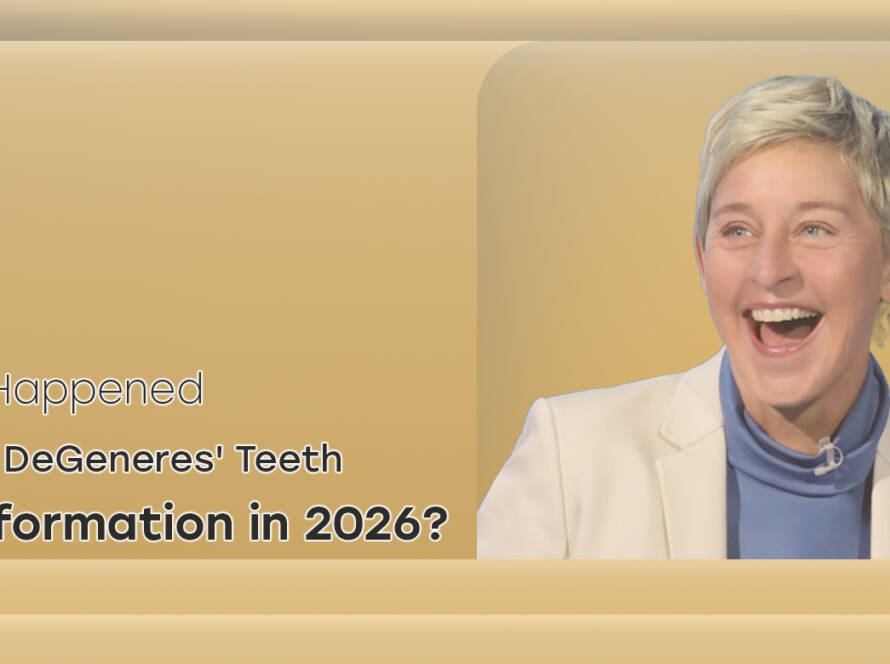 Ellen DeGeneres Teeth Transformation