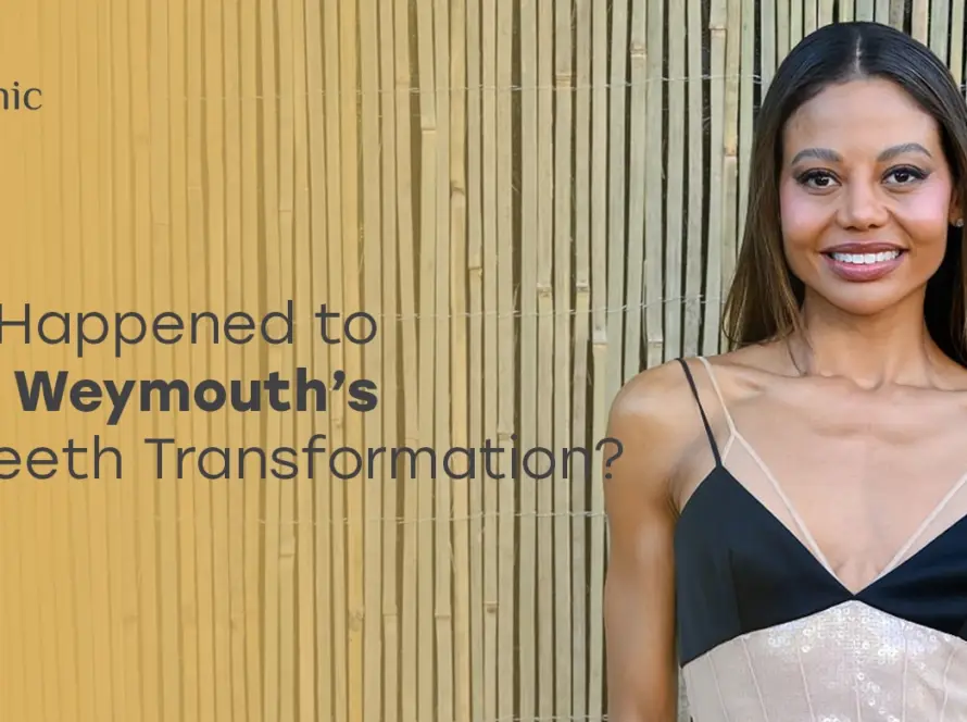 Emma Weymouth New Teeth