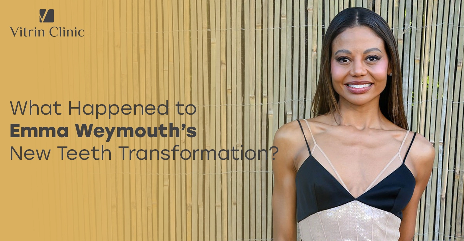 Emma Weymouth New Teeth