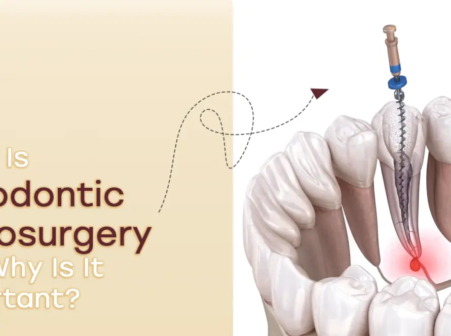 Endodontic microsurgery