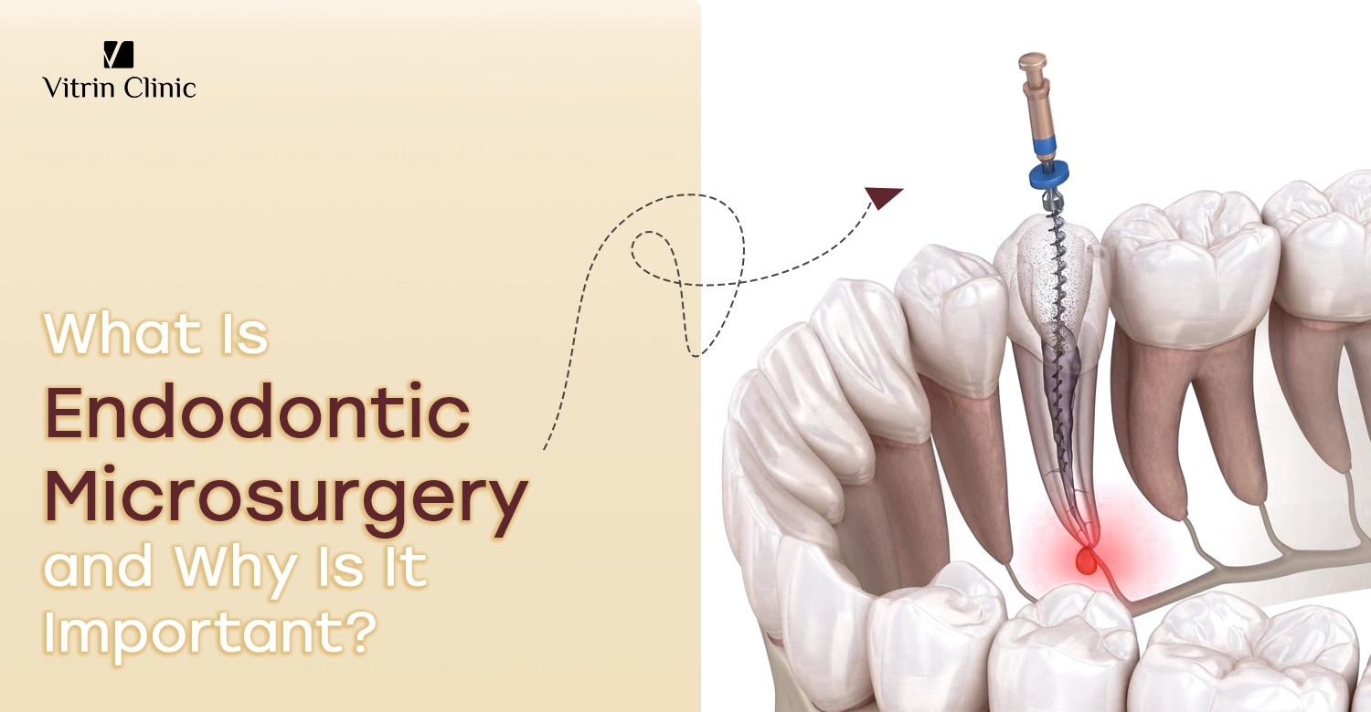 Endodontic microsurgery