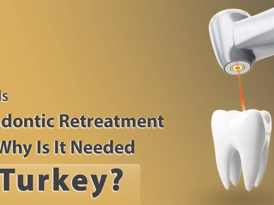 Endodontic retreatment