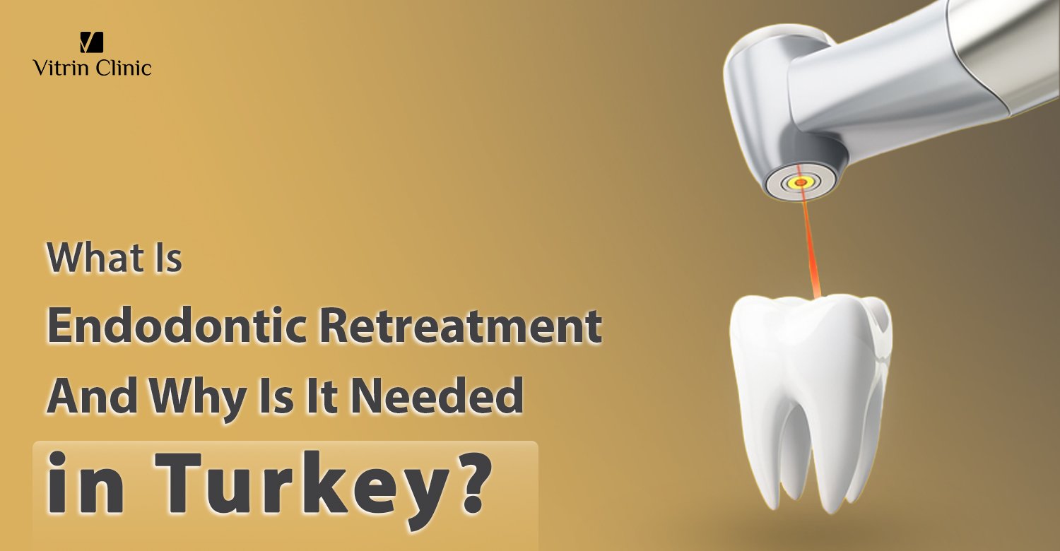 Endodontic retreatment