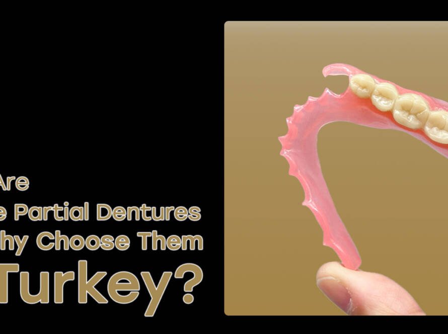 Flexible partial dentures