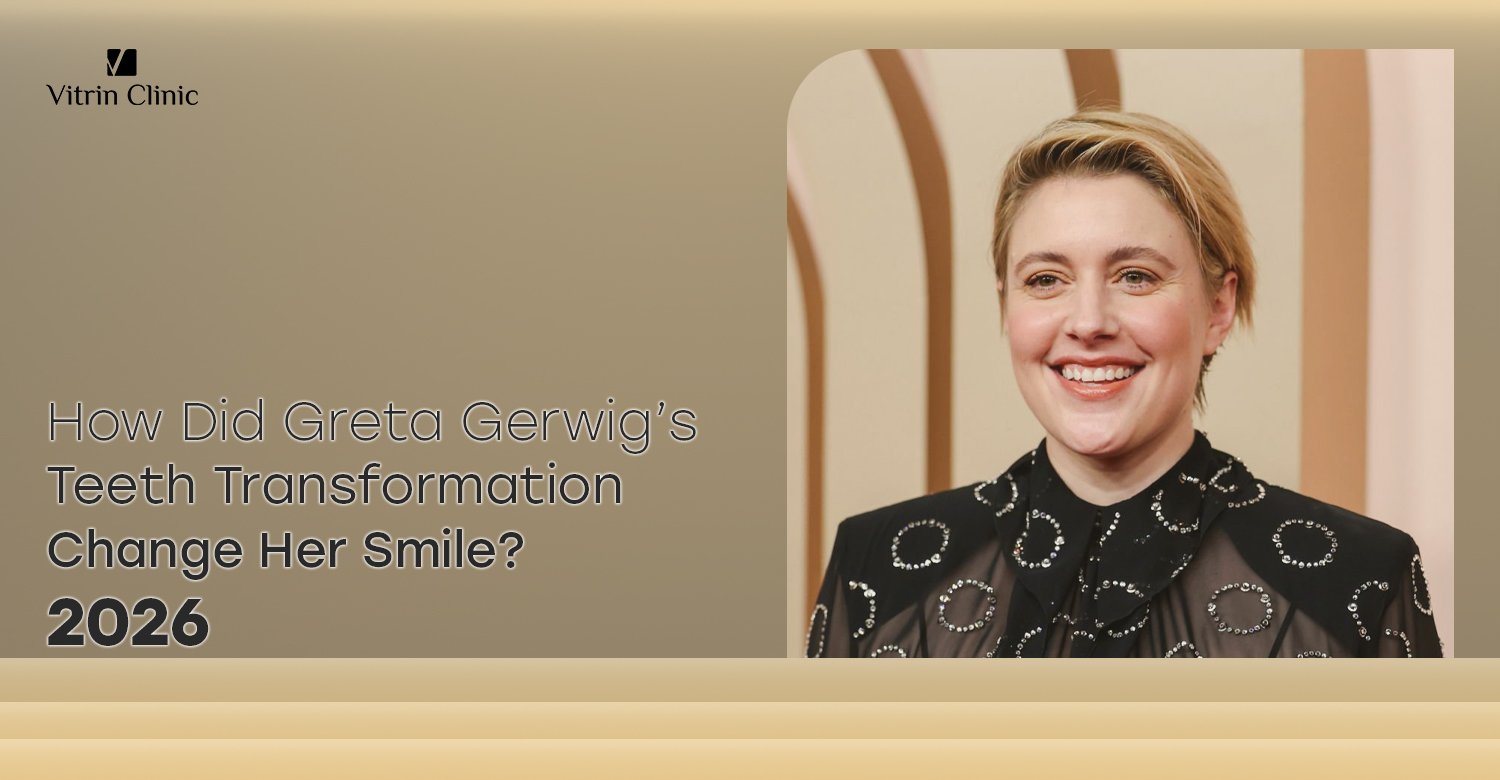 Greta Gerwig Teeth Transformation