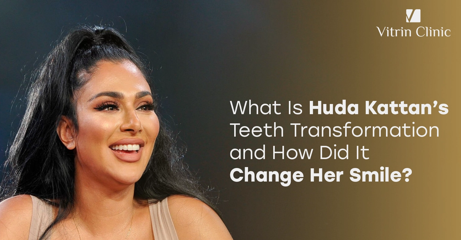 Huda Kattan Teeth Transformation