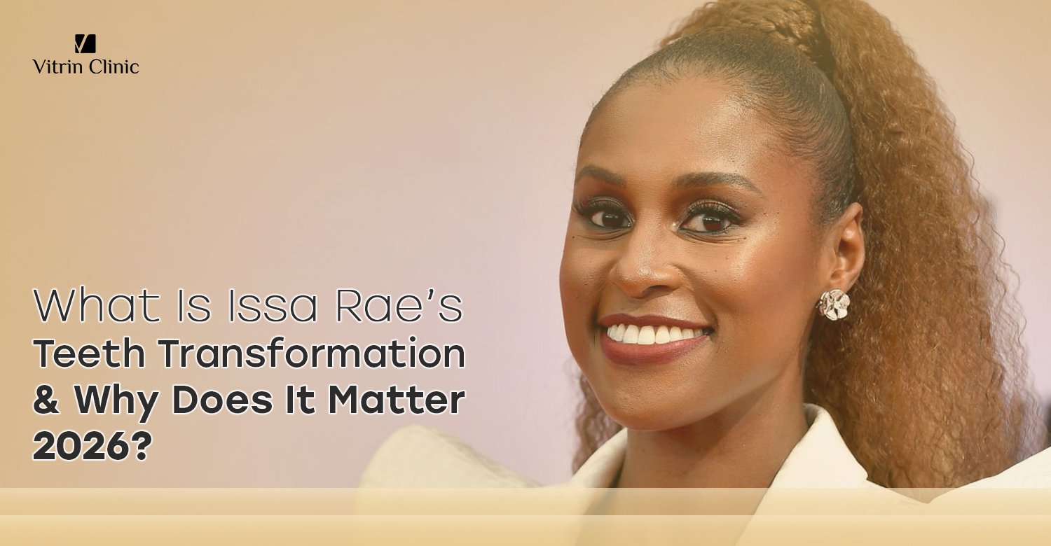 Issa Rae Teeth Transformation