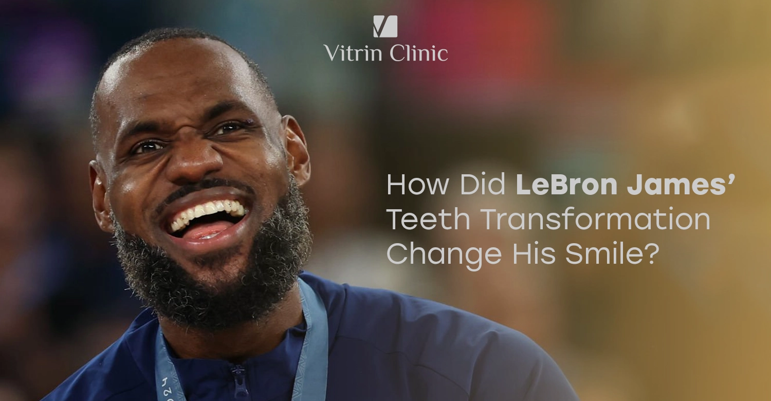 LeBron James Teeth Transformation