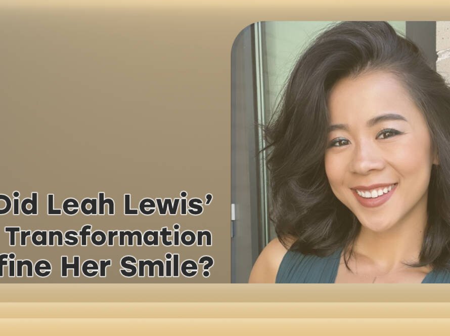 Leah Lewis Teeth Transformation