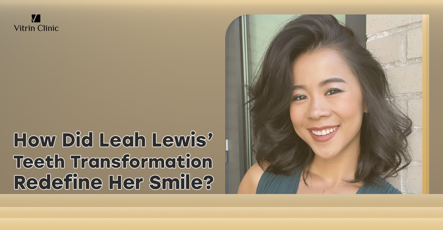 Leah Lewis Teeth Transformation