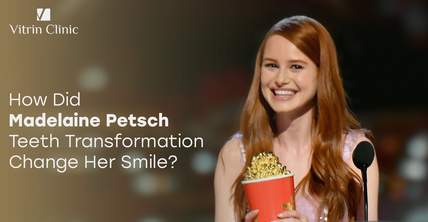 Madelaine Petsch Teeth Transformation