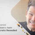 Mark Labbett Teeth – What’s Behind His Smile Transformation?