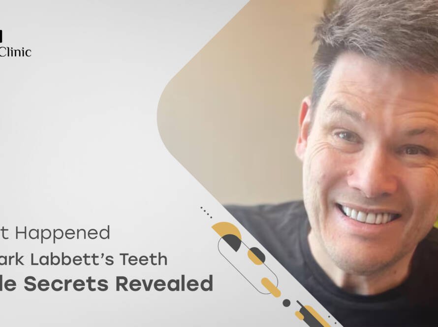 Mark Labbett Teeth