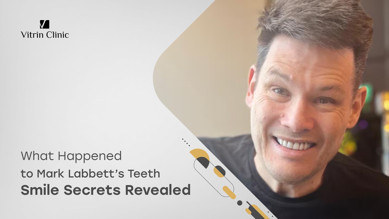Mark Labbett Teeth