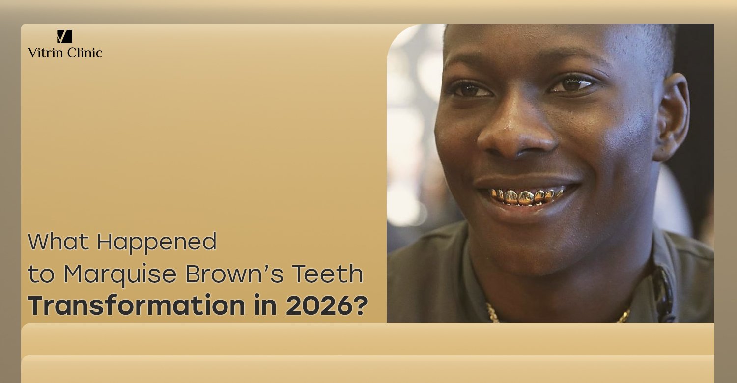 Marquise Brown Teeth