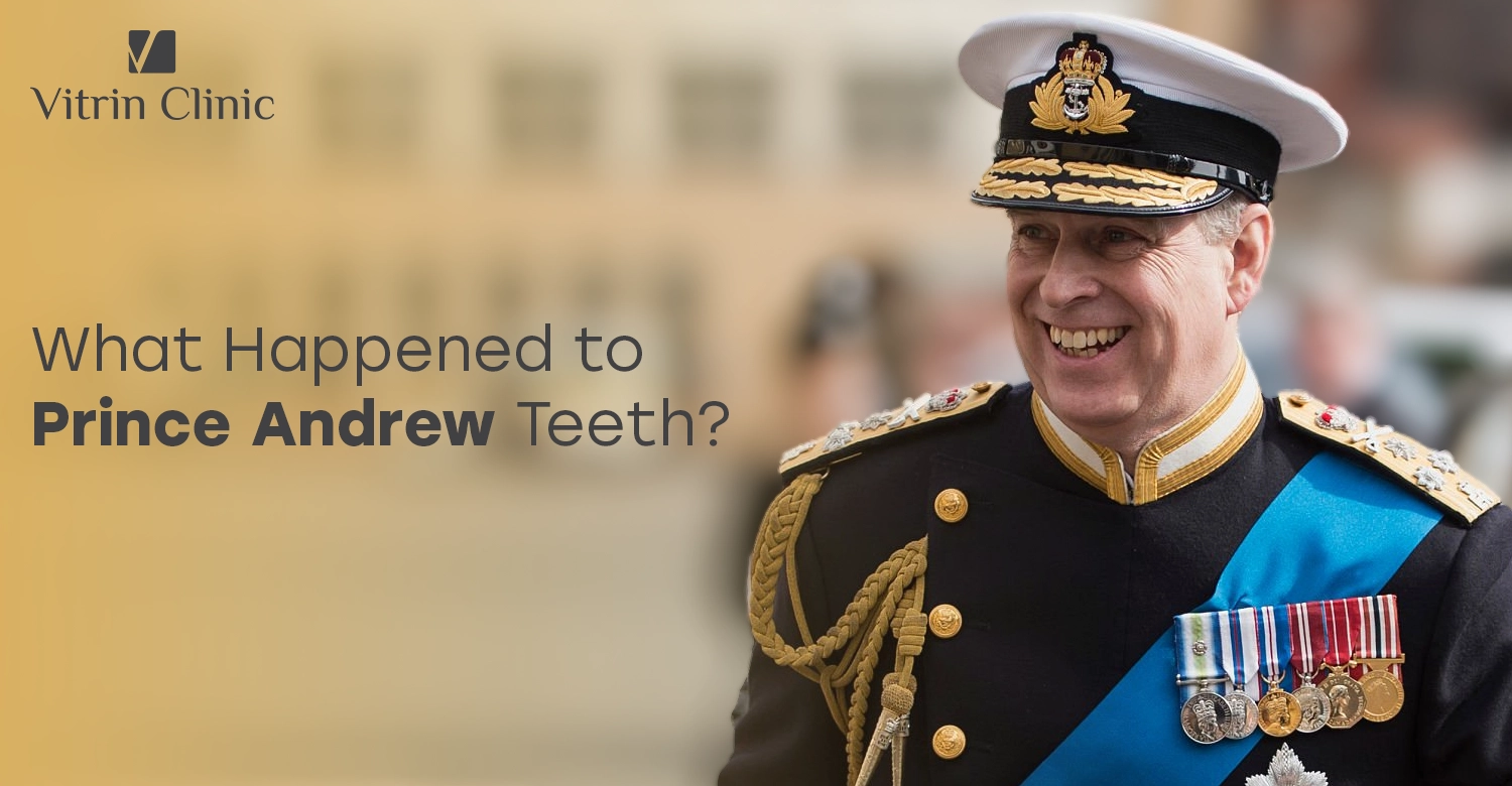 Prince Andrew Teeth