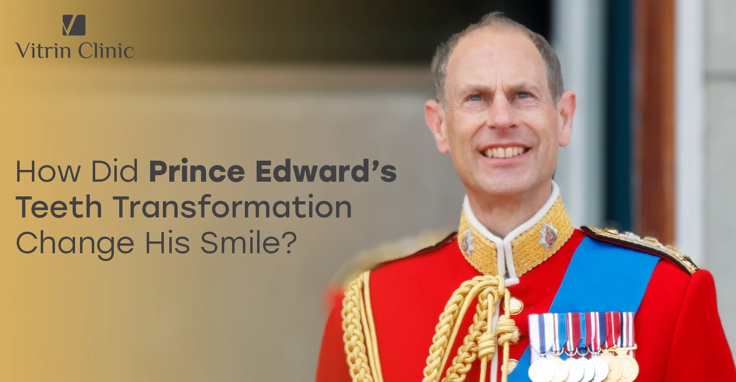 Prince Edward Teeth Transformation