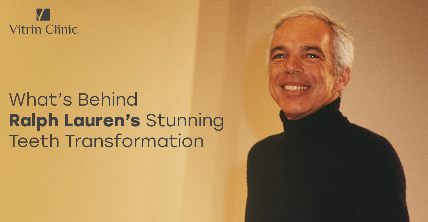 Ralph Lauren Teeth Transformation