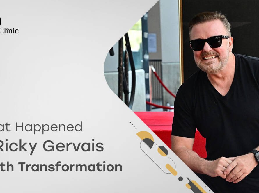 Ricky Gervais Teeth Transformation