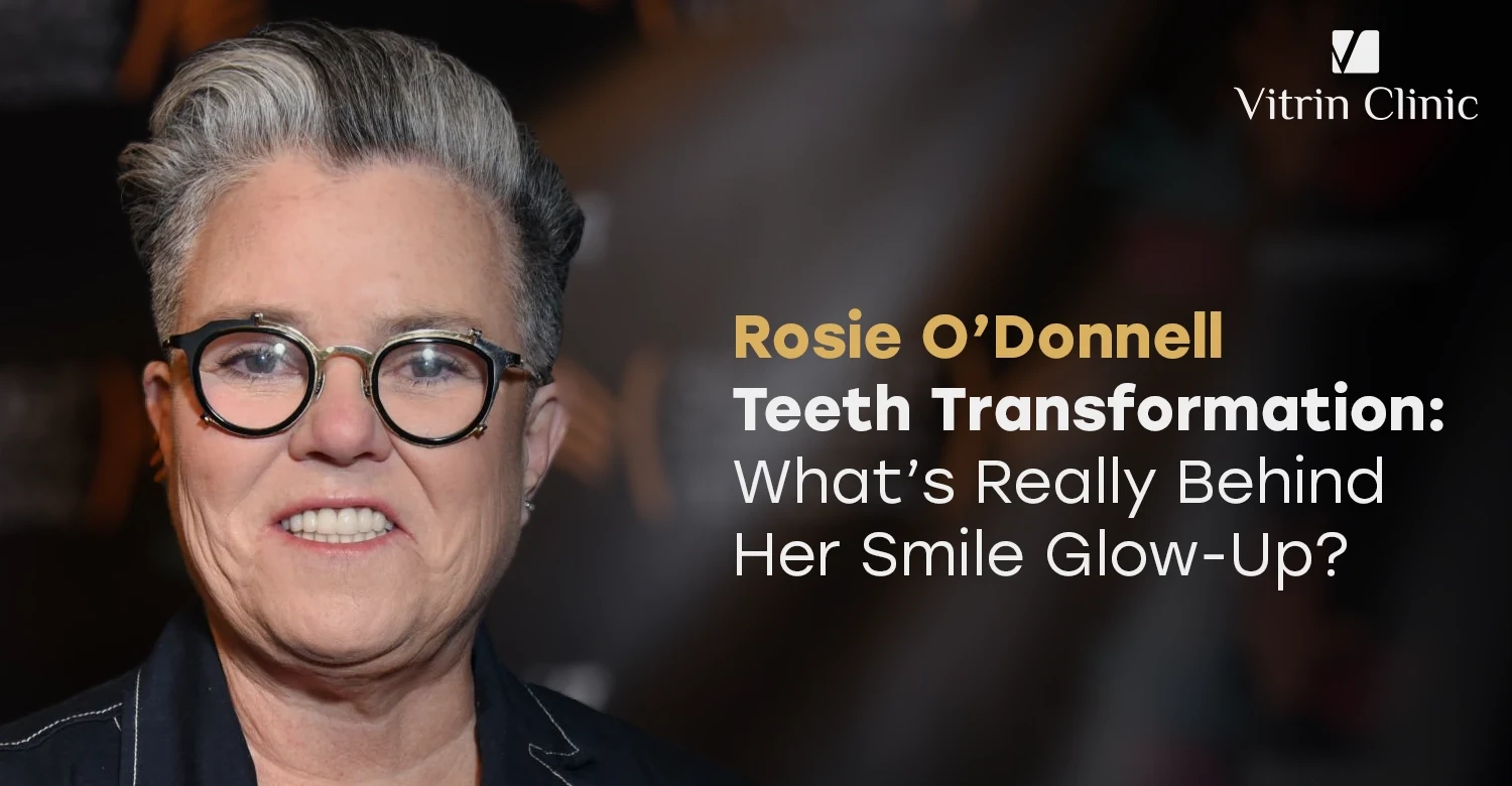 Rosie O’Donnell Teeth Transformation: What’s Really Behind Her Smile Glow-Up?