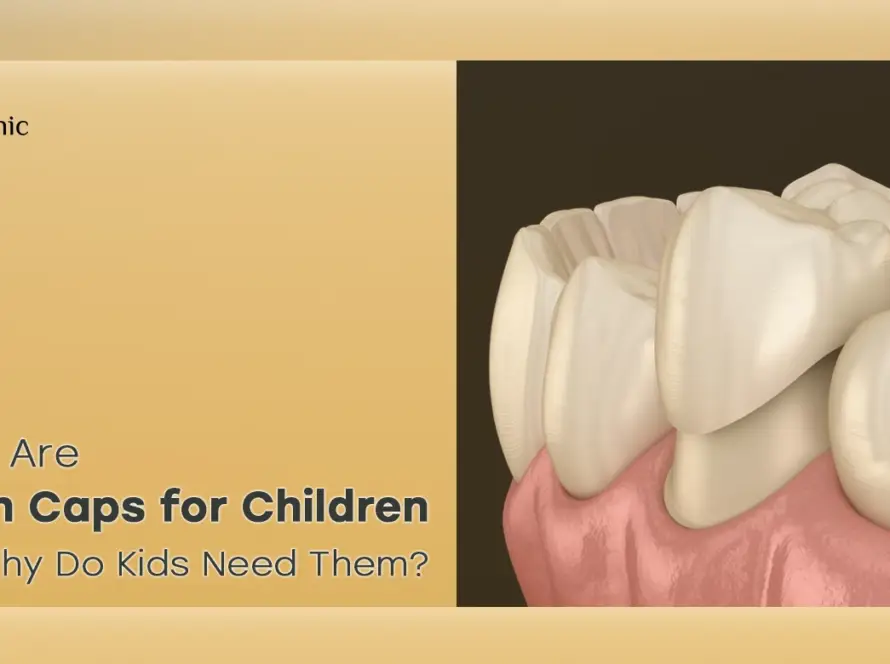Teeth caps for children