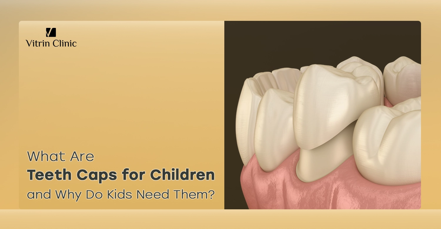 Teeth caps for children