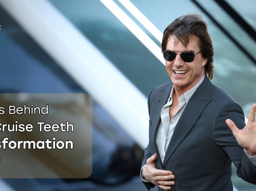Tom Cruise Teeth