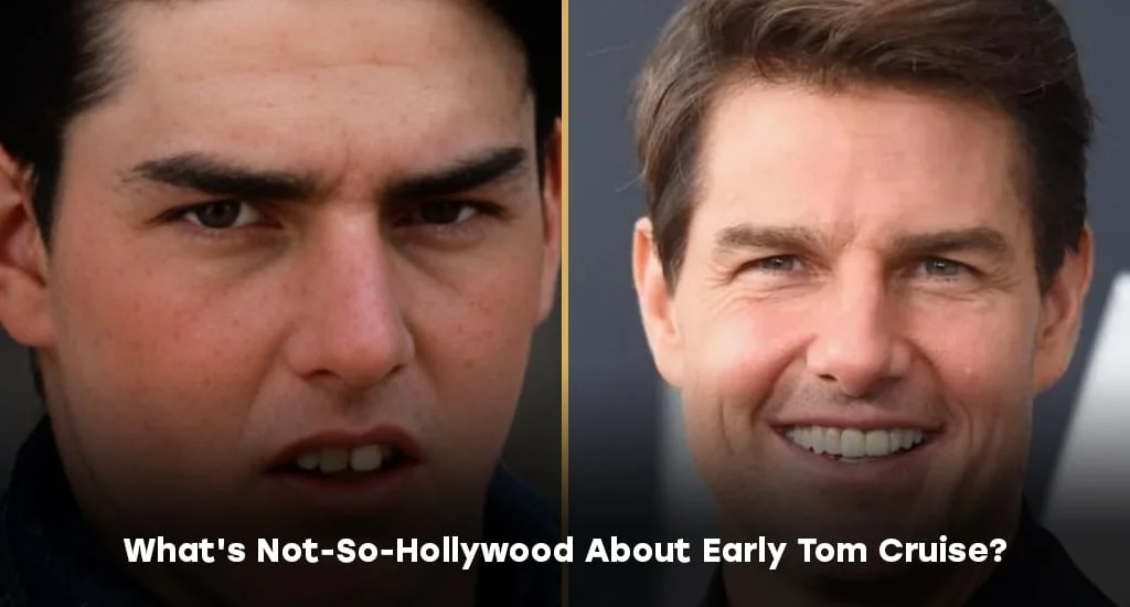 Tom Cruise dental work cost UK