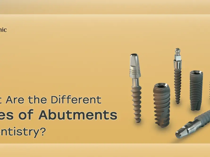 Types of abutments