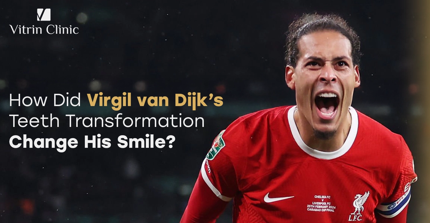Virgil van Dijk Teeth Transformation