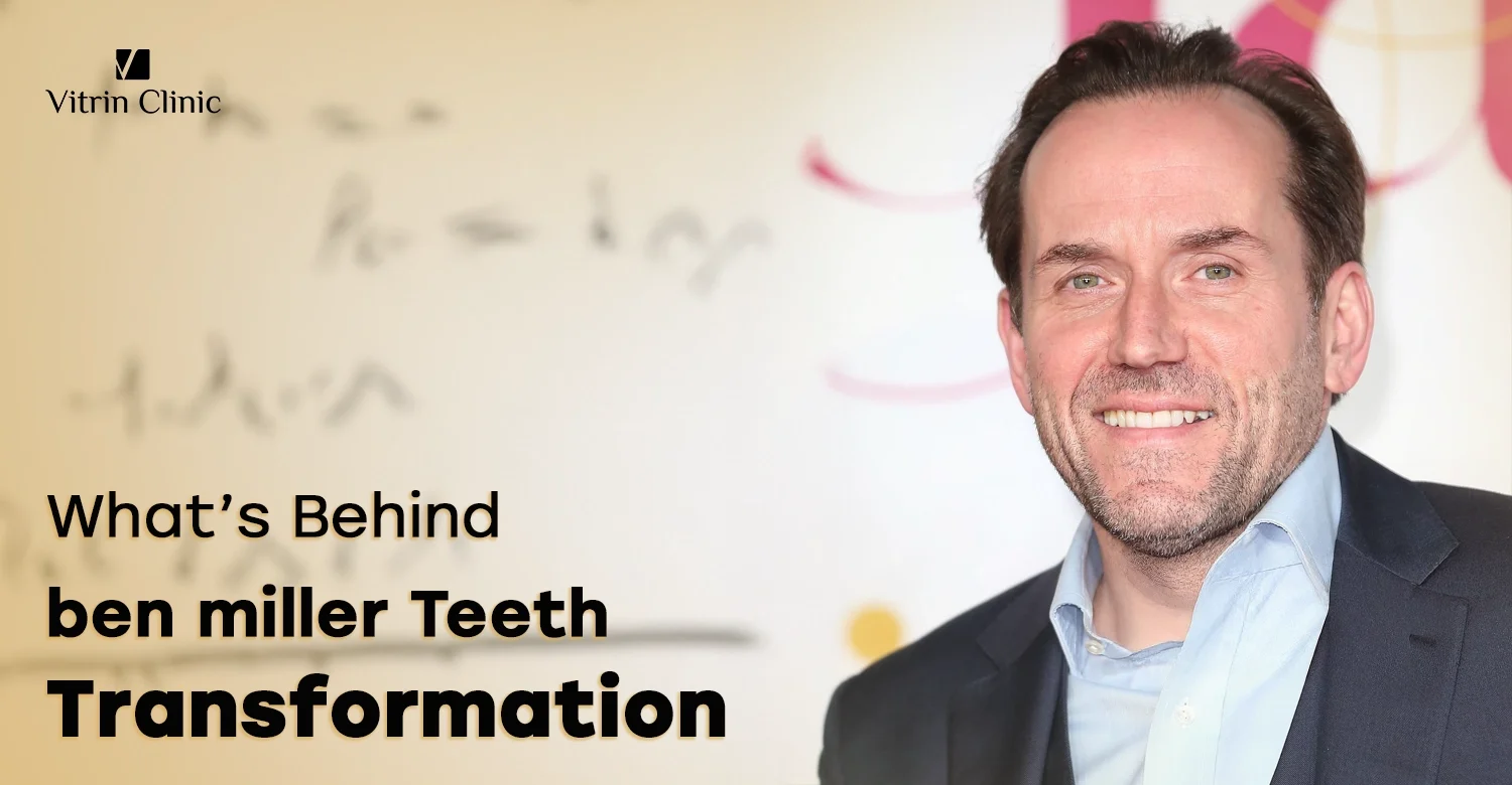 Ben Miller Teeth: The Truth Behind His Refined Smile