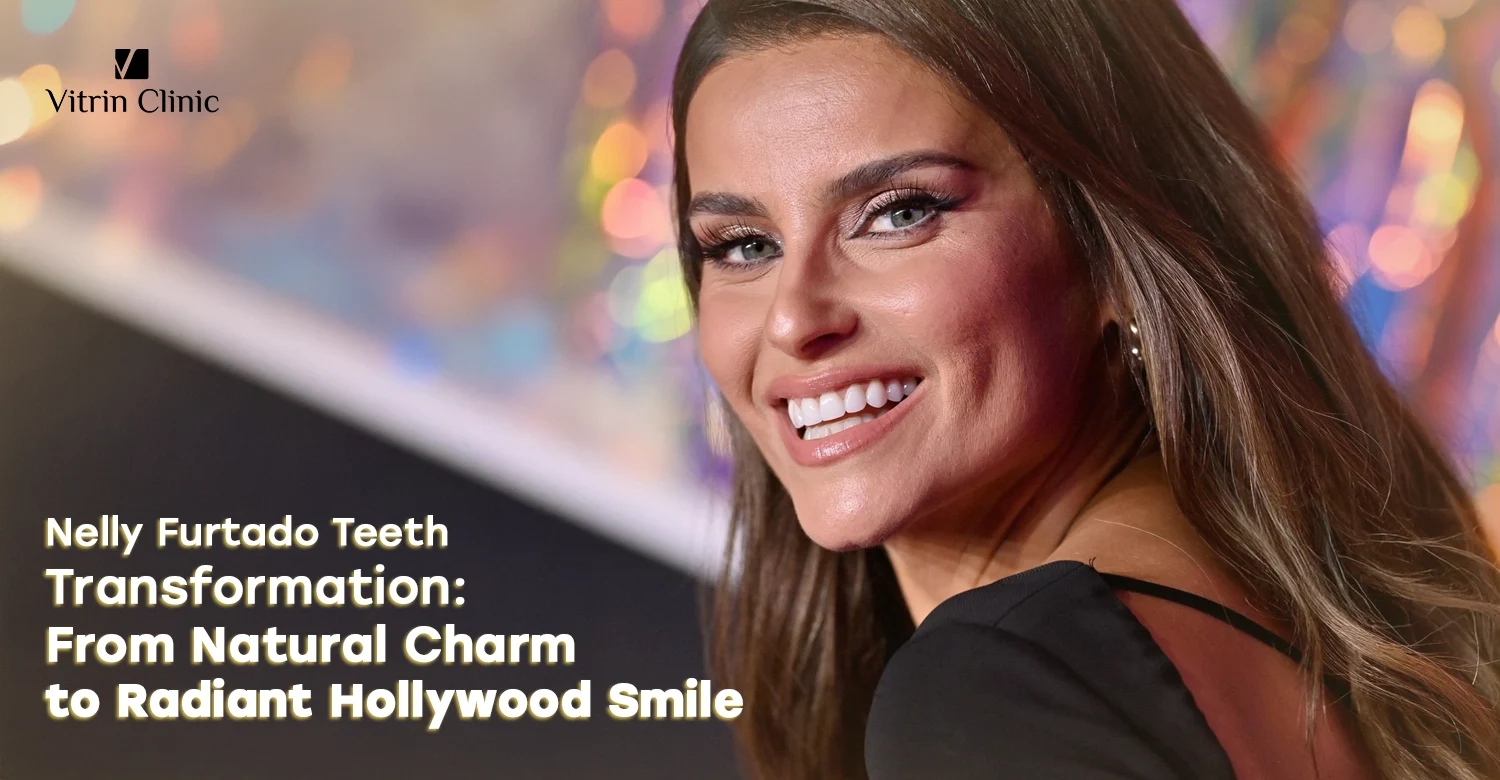 Explore Nelly Furtado Teeth transformation - Vitrin clinic