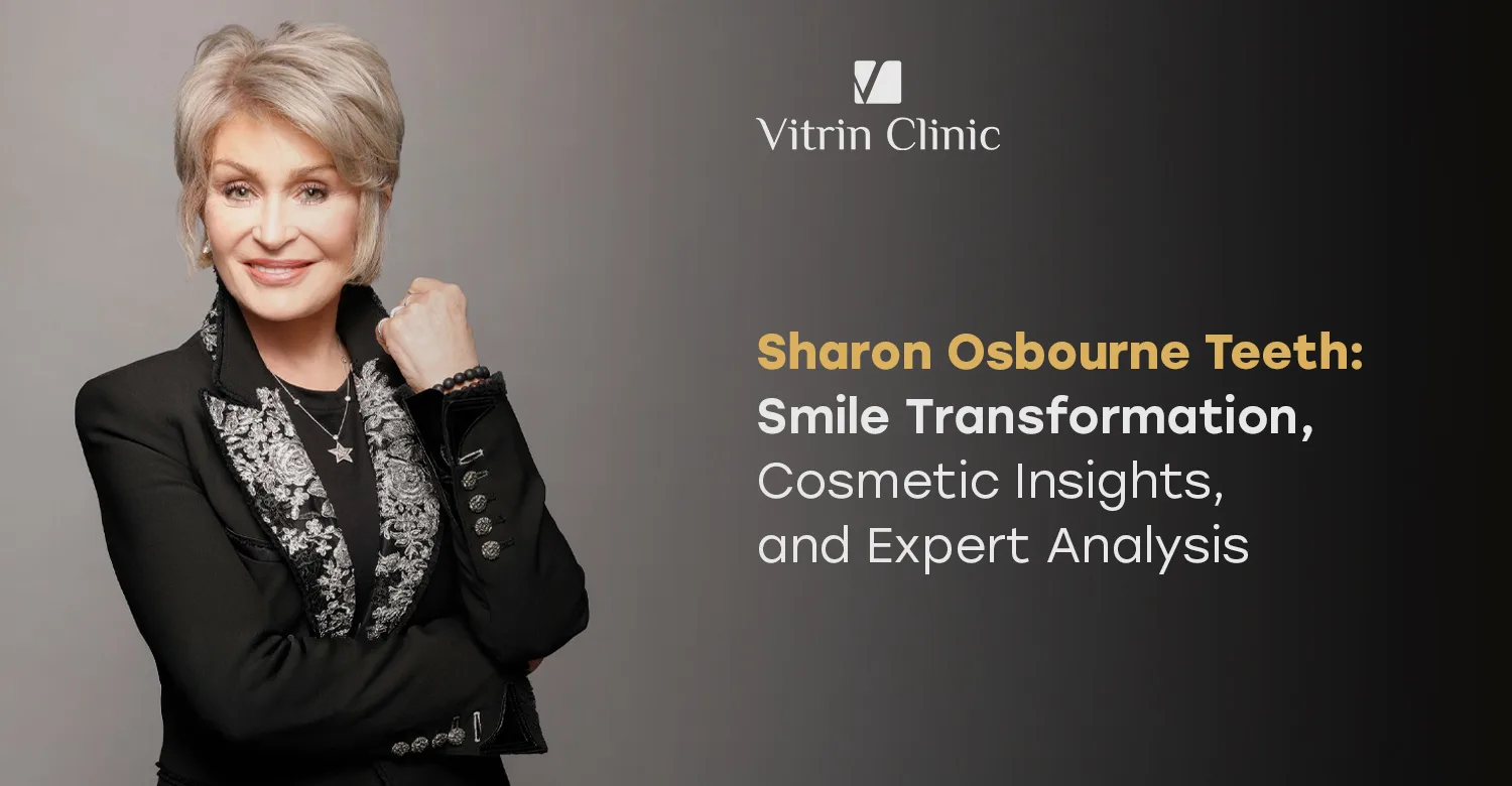 Sharon Osbourne Teeth