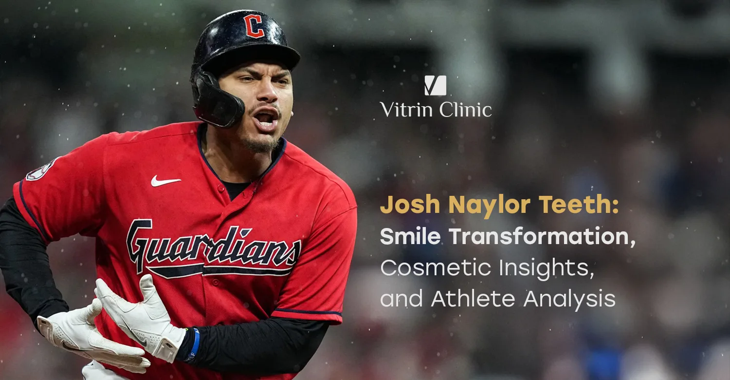 Josh Naylor Teeth