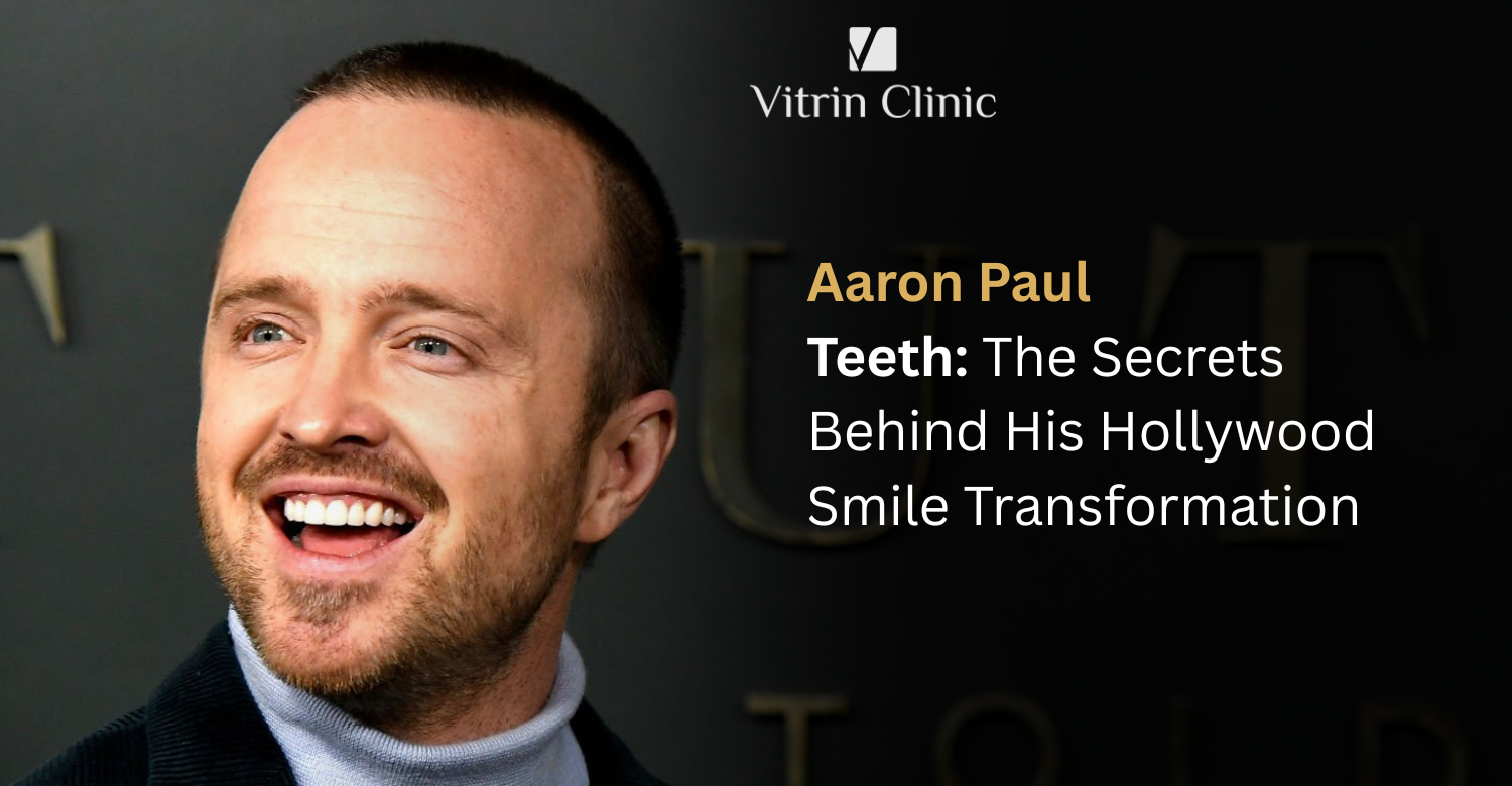 Aaron Paul Teeth: The Actor's Complete Smile Evolution