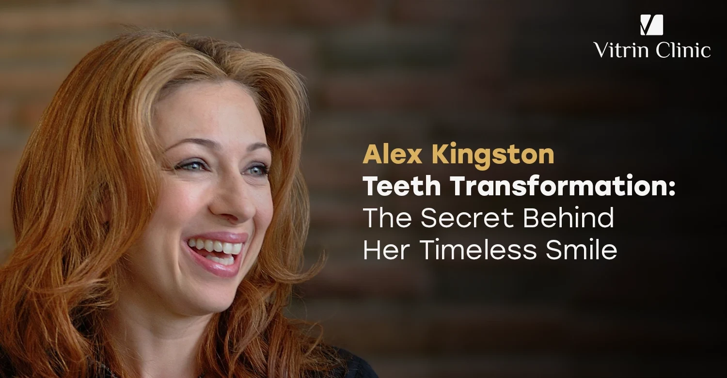 Alex Kingston Teeth