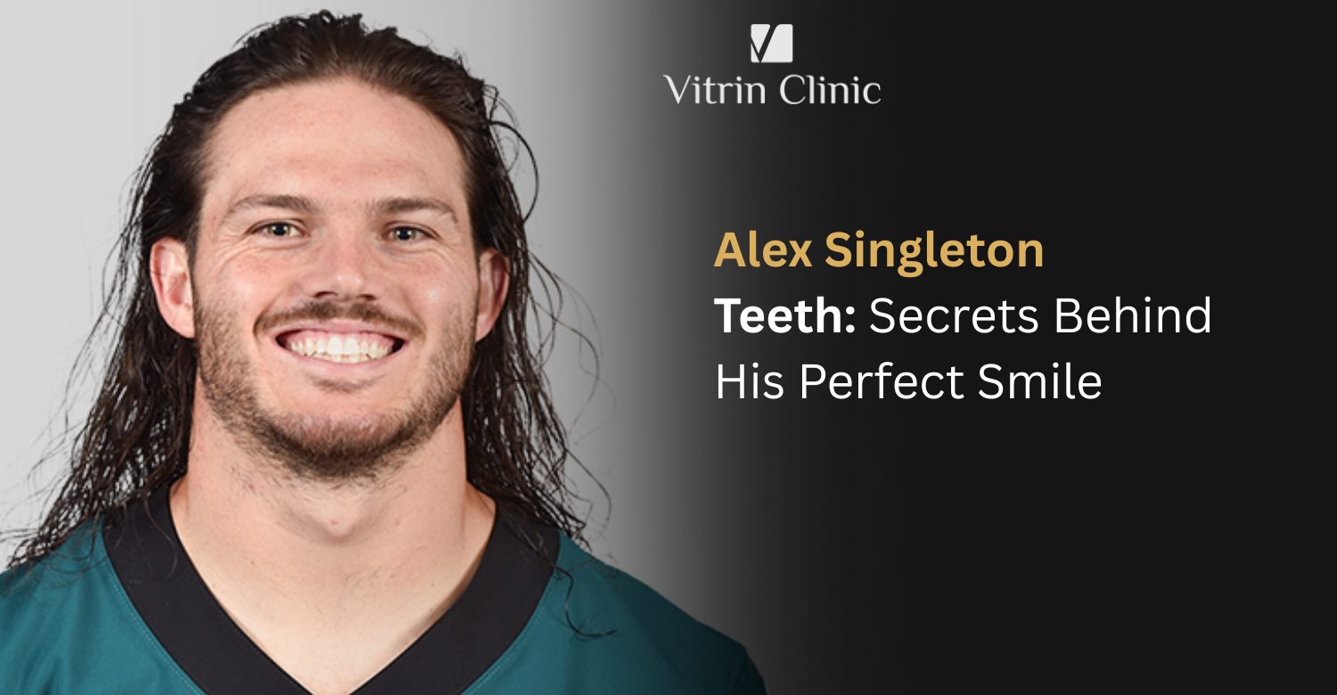 Alex Singleton Teeth