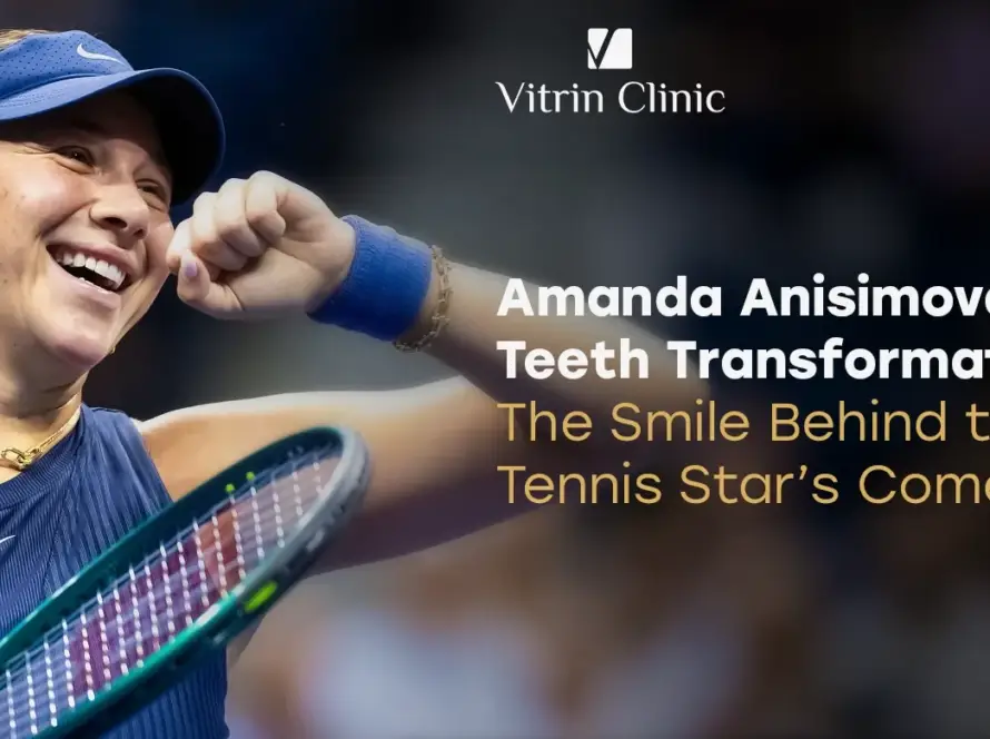 Amanda Anisimova Teeth: The Tennis Star's Smile Transformation