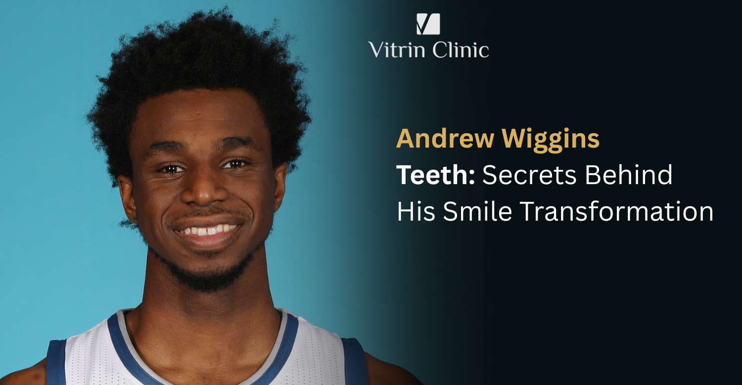 Andrew Wiggins Teeth